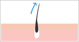 ムダ毛再生のイメージ図